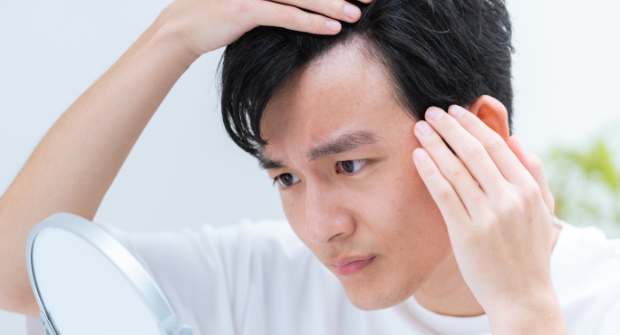 AGAセルフチェック